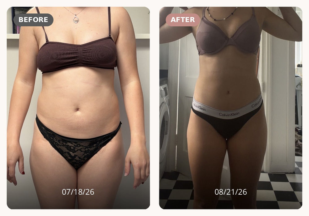 Client before and after, front view